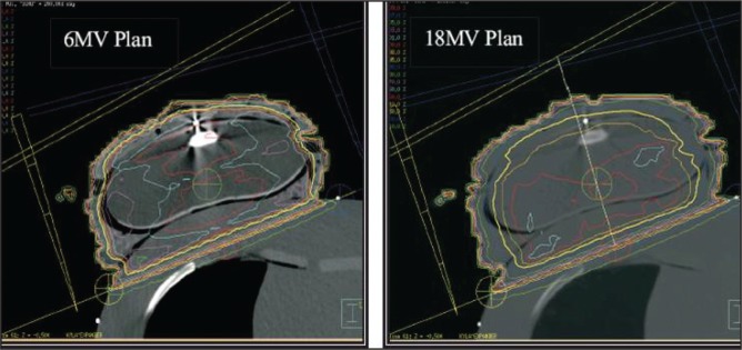 Figure 4)