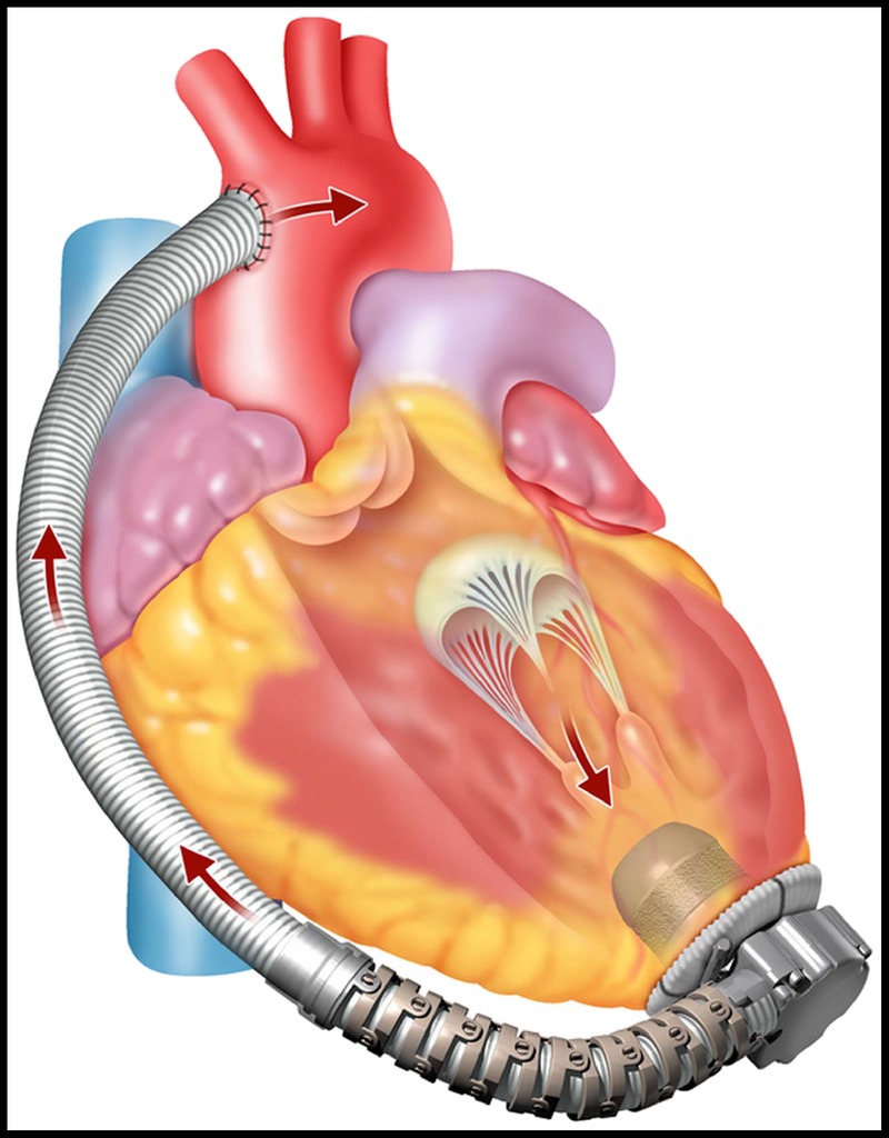 FIGURE 2