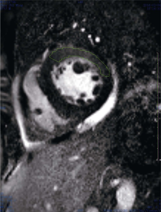 Figure 2.