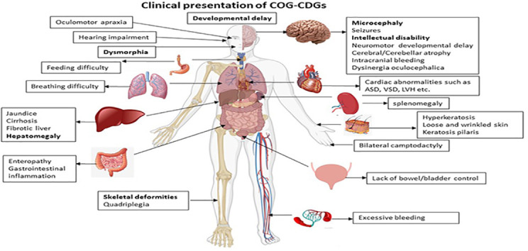 Unlabelled Image