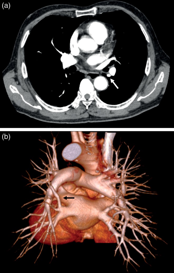 Figure 1: