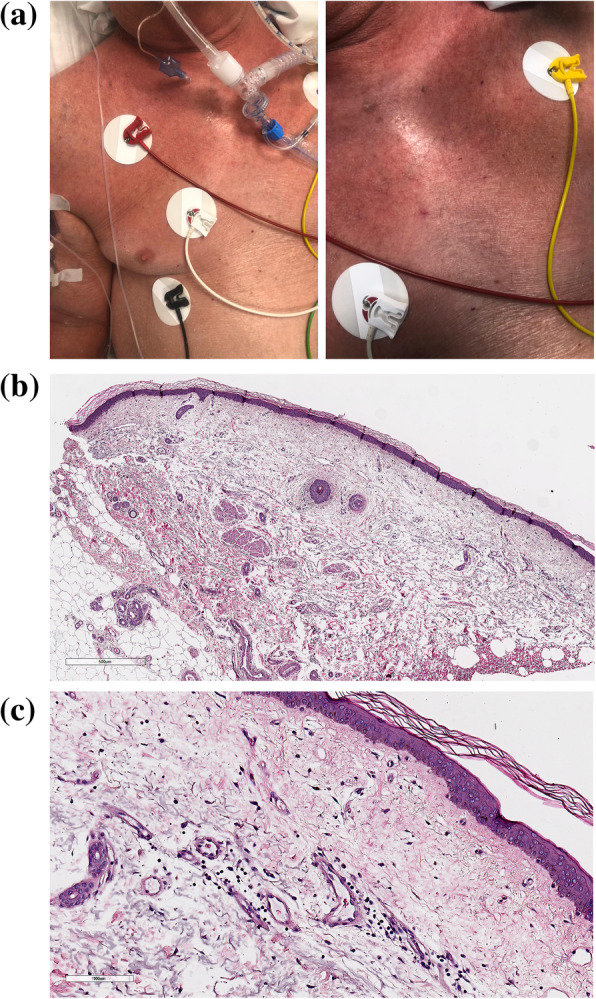 Fig. 2