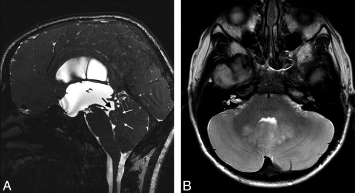 Fig 3.