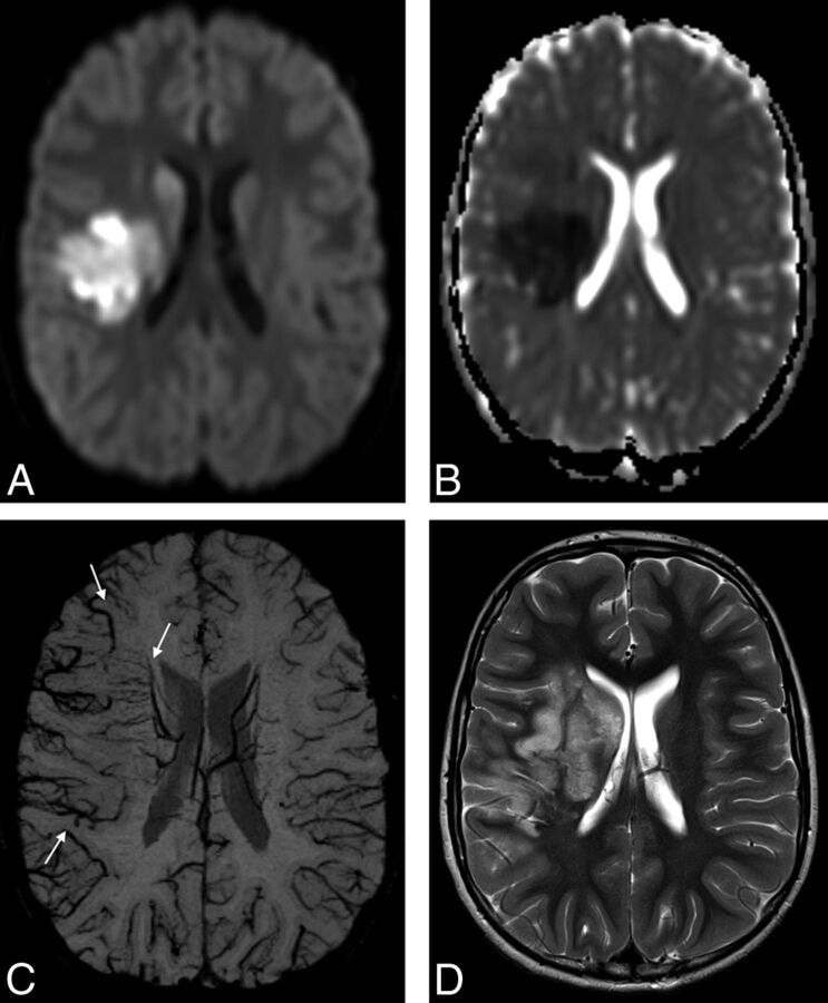 Fig 1.