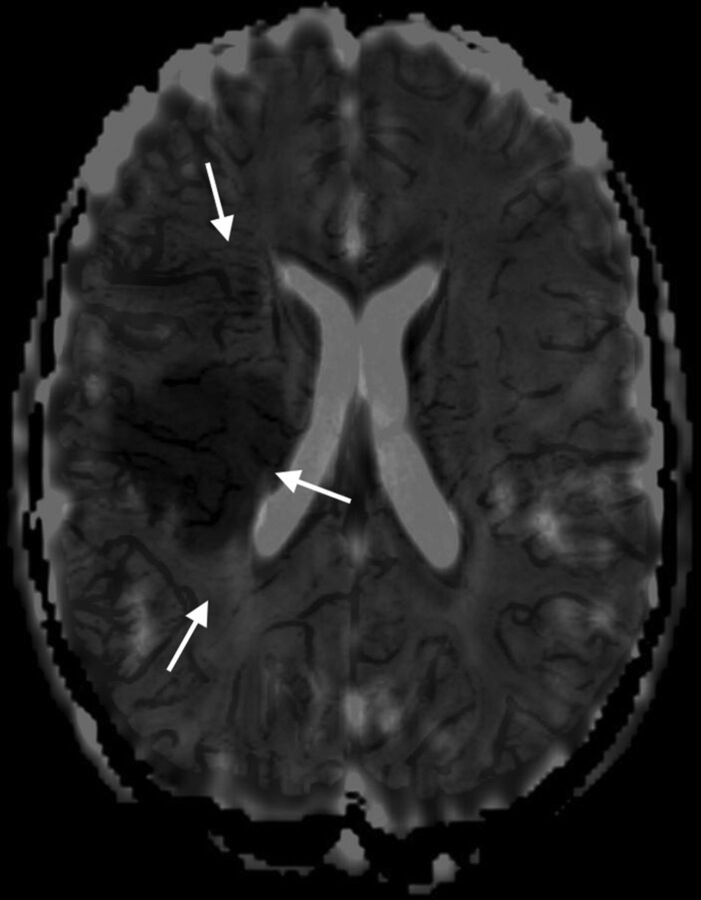 Fig 2.