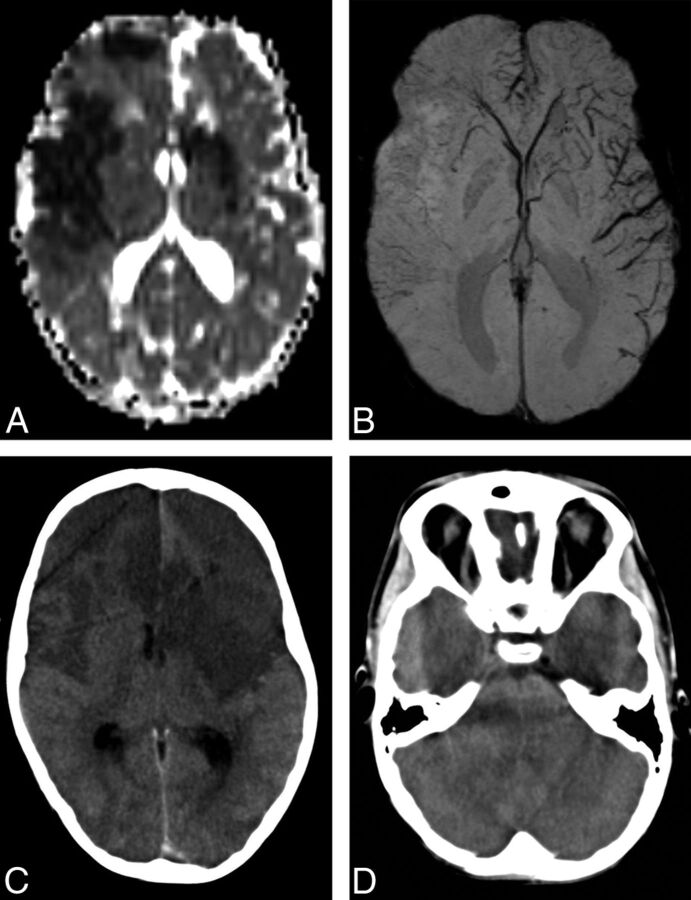 Fig 3.