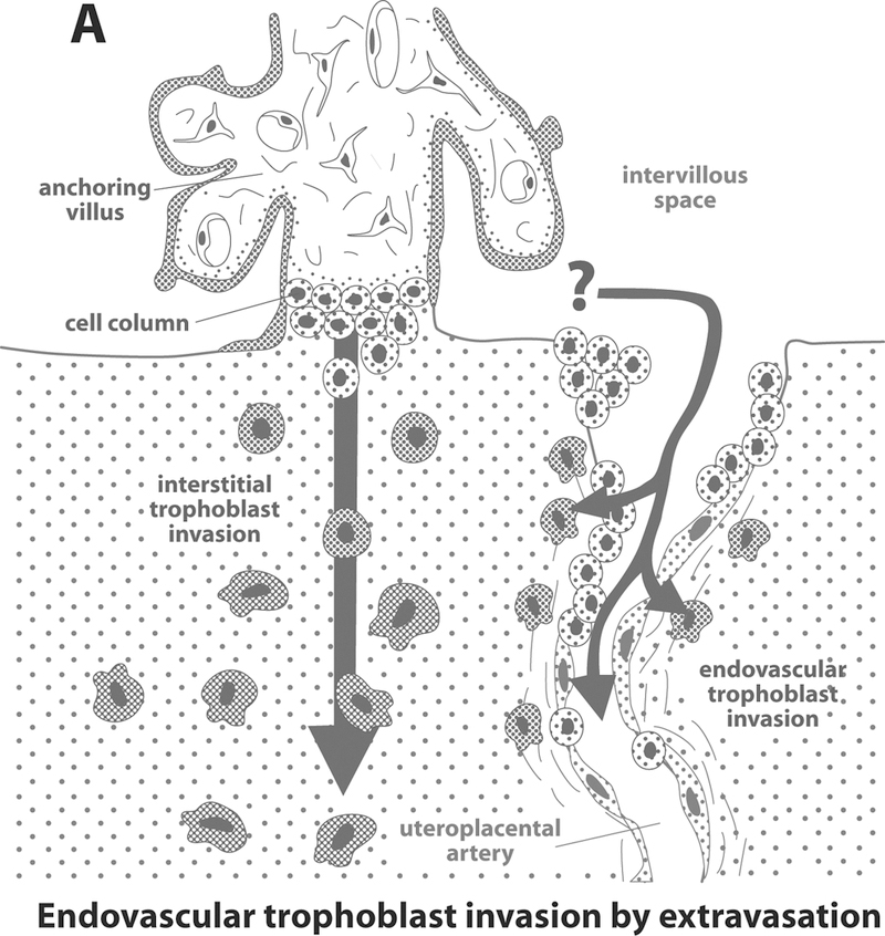 NORMAL AND ABNORMAL TRANSFORMATION OF THE SPIRAL ARTERIES DURING ...