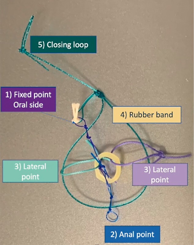 Fig. 1