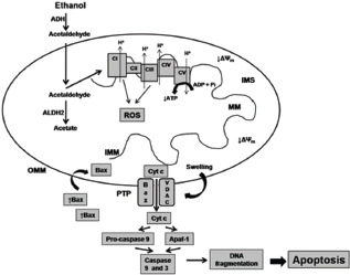 a Reproduced from Manzo-Avalos and Saavedra-Molina.12 Abbreviations: Δψm, mitochondrial membrane potential; ADH, alcohol dehydrogenase; ADP, adenosine diphosphate; ALDH2, mitochondrial aldehyde dehydrogenase 2; Apaf-1, apoptotic protease activating factor-1; ATP, adenosine triphosphate; (CI-CIV), electron transport complexes; Cyt c, cytochrome c; IMM, inner mitochondrial membrane; IMS, intramitochondrial space; MM, mitochondrial matrix; OMM, outer mitochondrial membrane; PTP, permeability transition pore; ROS, reactive oxygen species; VDAC, voltage-dependent anion channel.