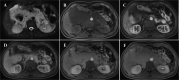 Fig 5