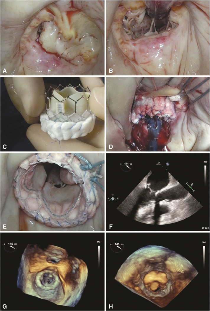 Figure 4