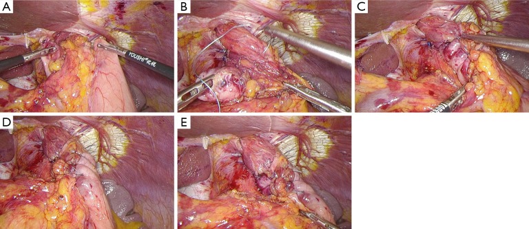 Figure 14