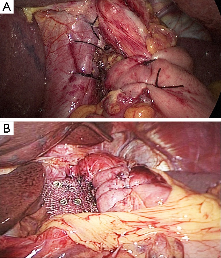 Figure 15