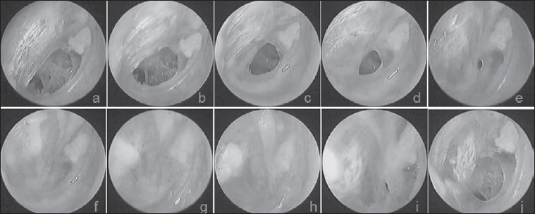 Fig. 4.