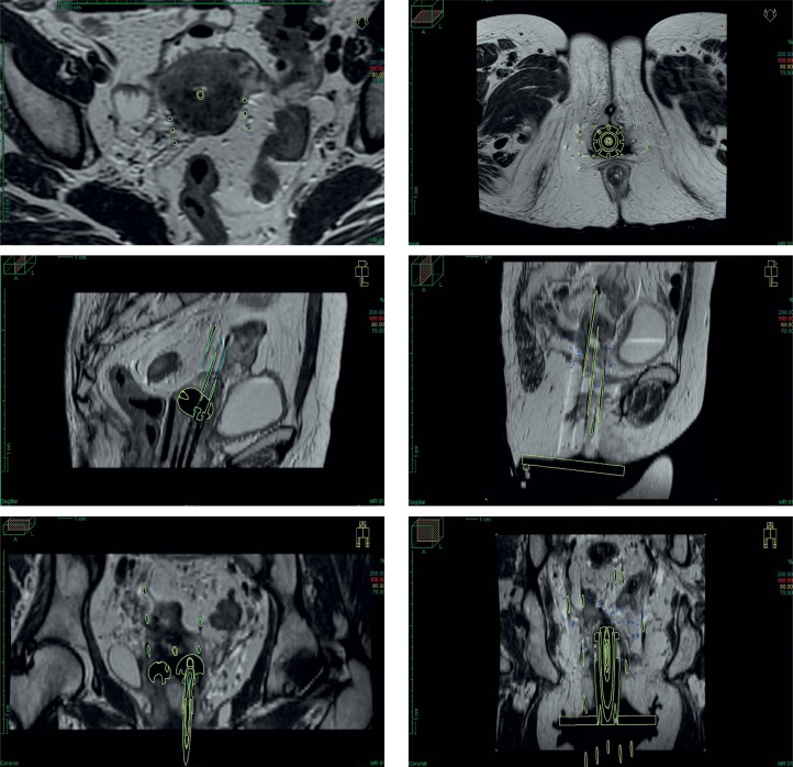 Fig. 6