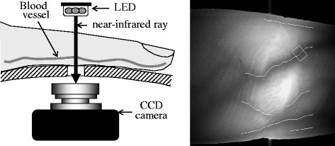 Fig. 1