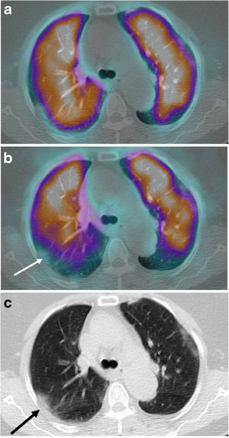 Fig. 5