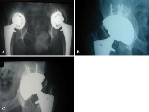 Fig. 1A–C