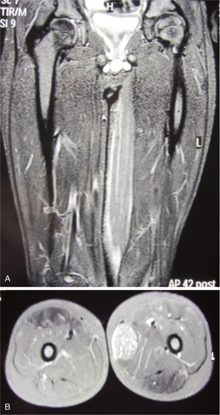 Figure 2 A–B.