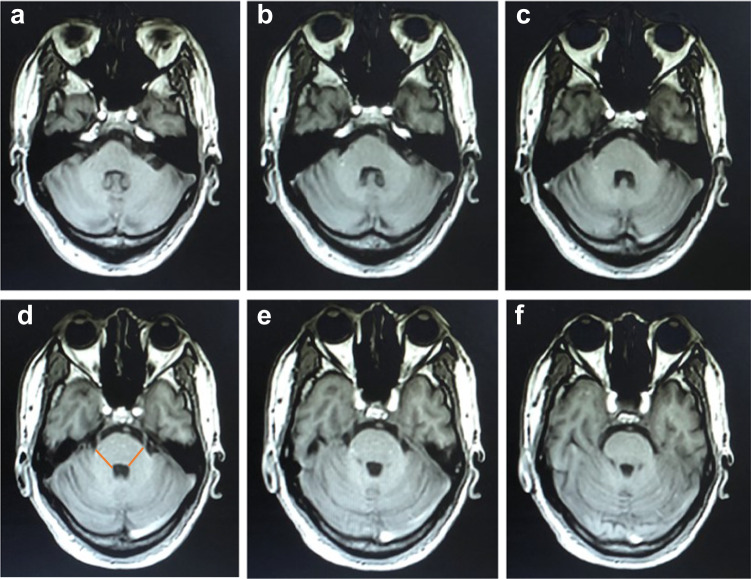 Fig. 4