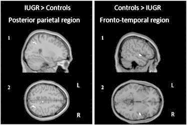 Fig. 4