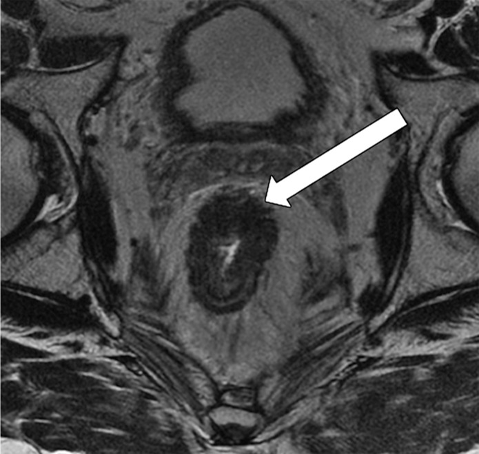 Figure 14e.