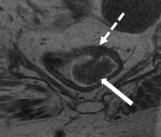 Figure 10b.