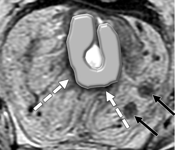 Figure 8c.