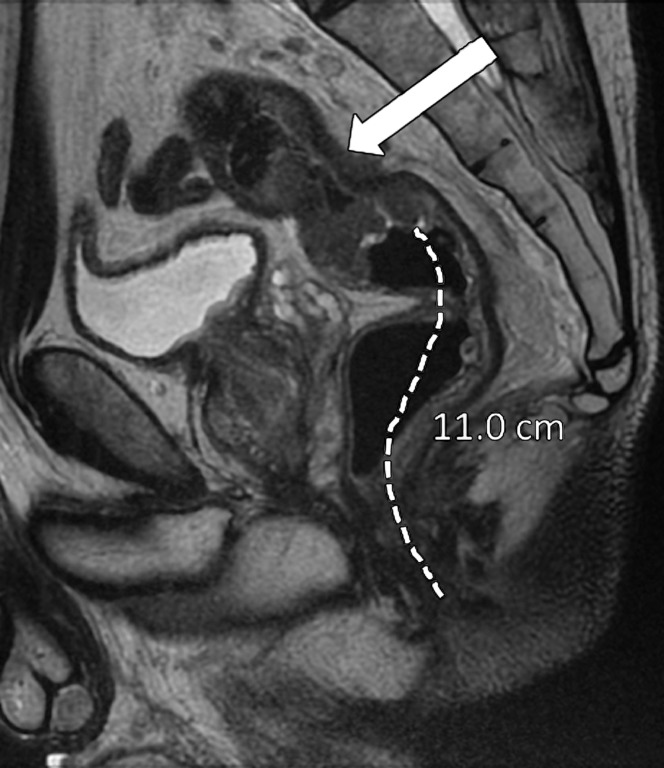 Figure 6b.