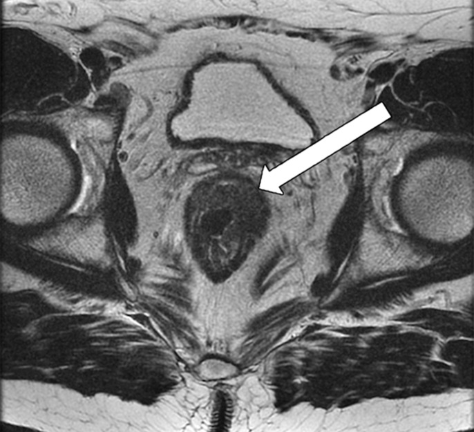 Figure 14a.