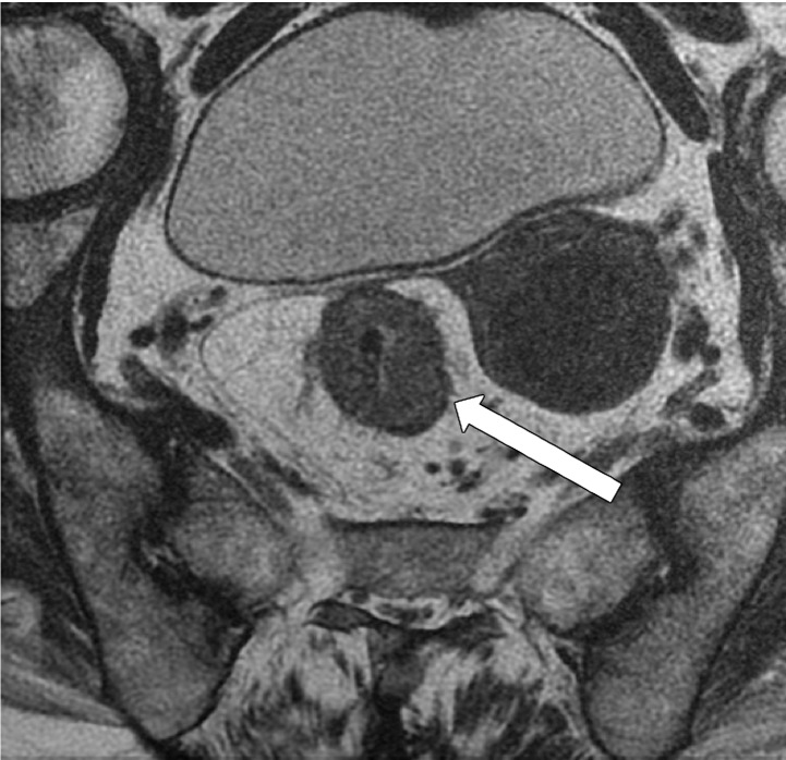 Figure 7b.