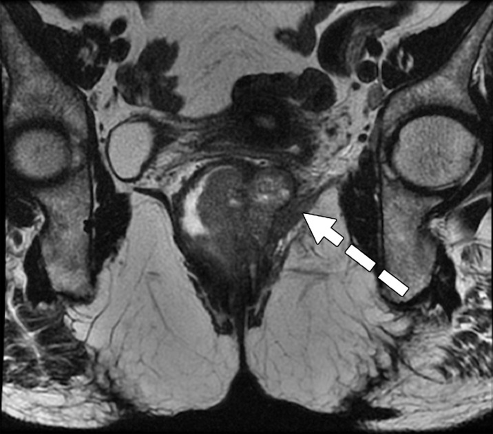 Figure 11d.