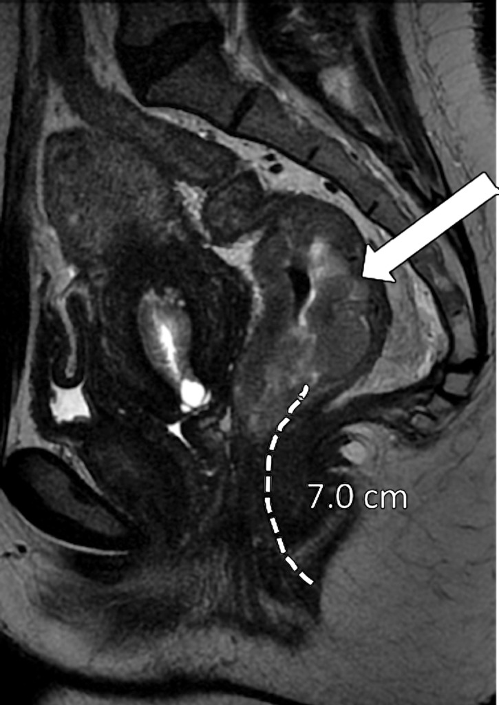 Figure 6c.