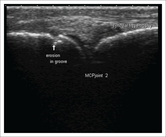 FIGURE 3