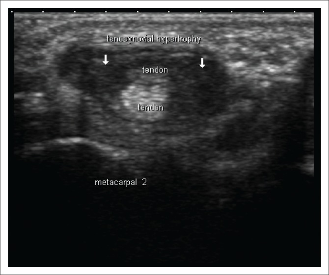 FIGURE 2