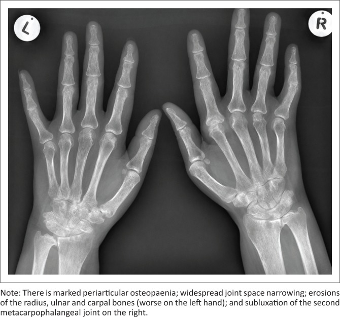 FIGURE 1