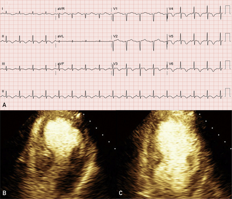 Figure 1