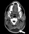 FIG 1