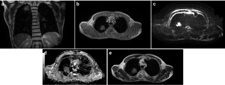 FIG. 2. a–e.