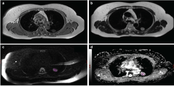 FIG. 1. a–d.