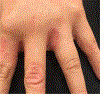 Fig. 12