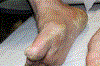Fig. 11