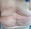 Fig. 13