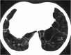 Fig. 43