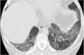 Fig. 21