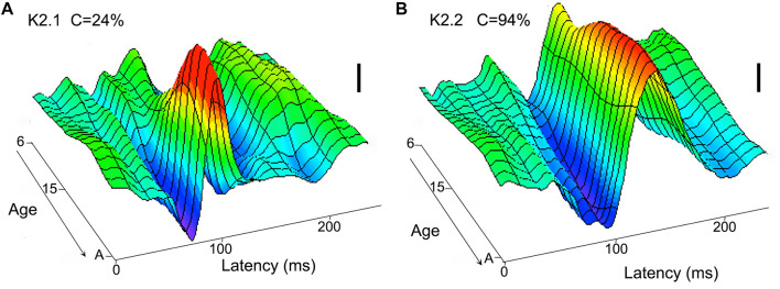 FIGURE 2