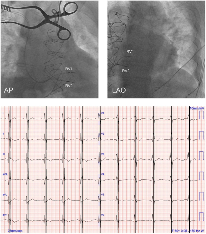 Figure 2