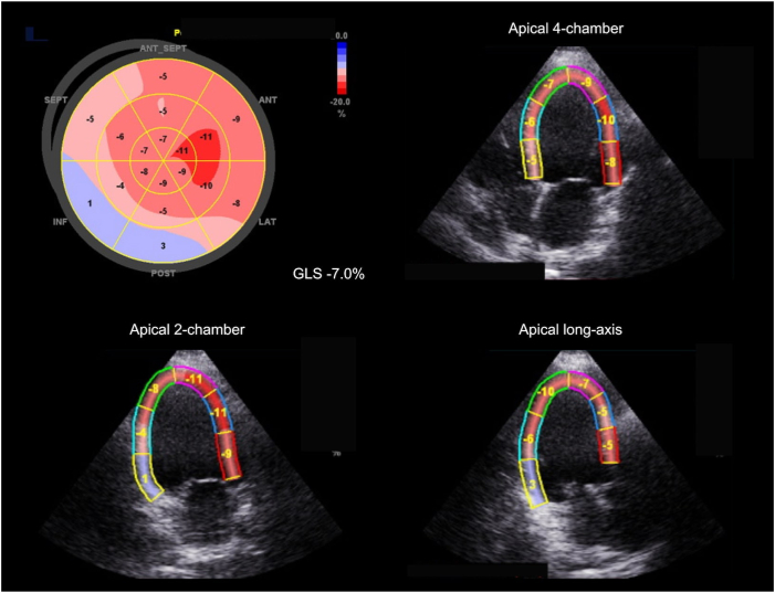 Figure 3