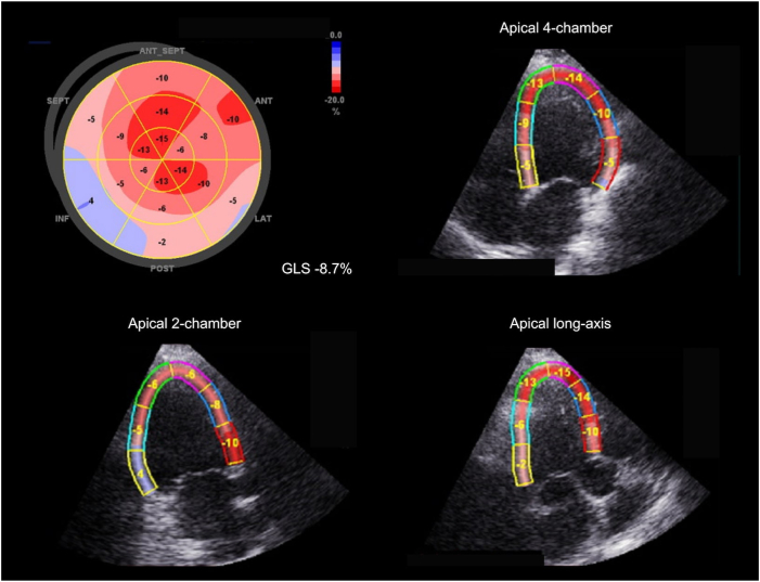 Figure 1