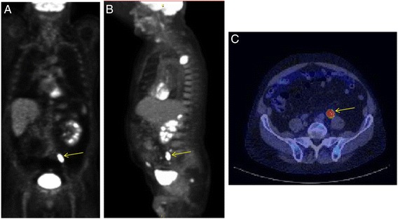 Fig. 2